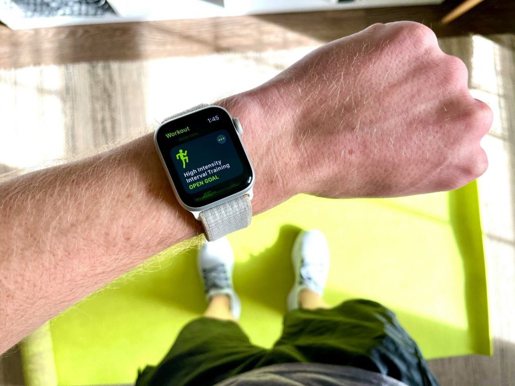 „Apple Watch“ populiarumas blėsta: Kas nutiko? 3 priežastys