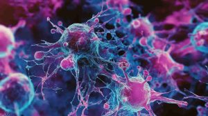 Ultragarsas prieš vėžį – gydymas be pjūvio, chemijos ir skausmo?