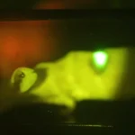 Atsiradus uždegimui oda nušvis žalia spalva: Japonija pristatė neįtikėtiną implantą