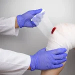 Mokslininkai atrado būdą sustabdyti gausų kraujavimą per vieną sekundę