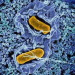 Mokslininkai rado pigesnį būdą gaminti antibiotikus nuo atsparios tuberkuliozės