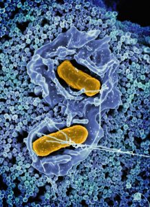 Mokslininkai rado pigesnį būdą gaminti antibiotikus nuo atsparios tuberkuliozės
