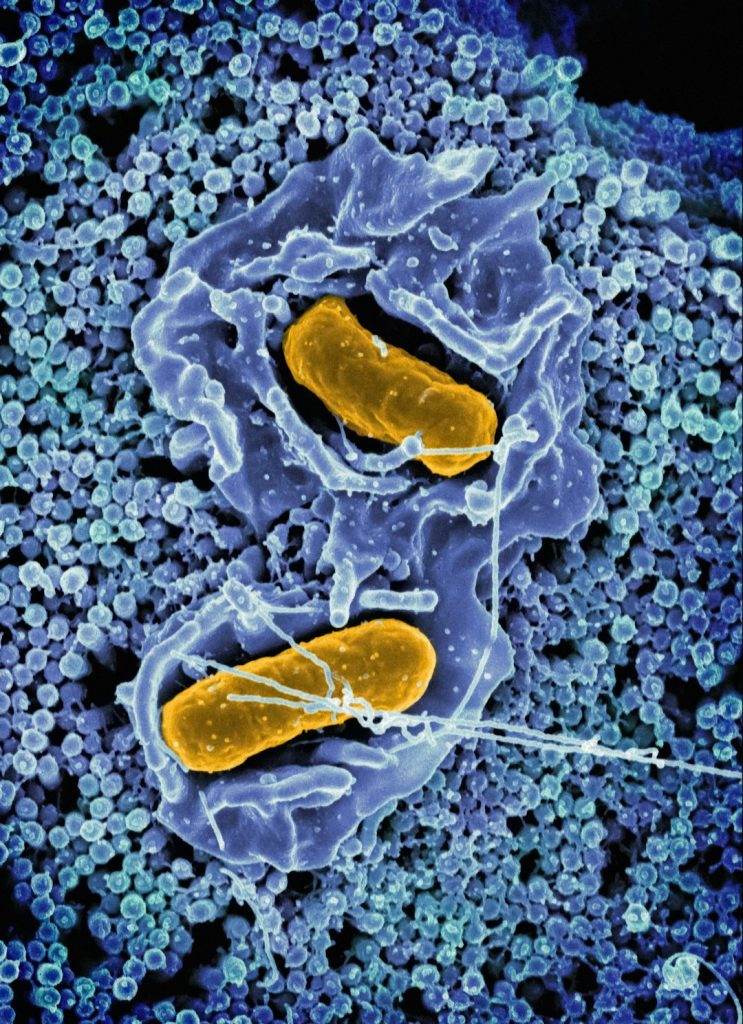 Mokslininkai rado pigesnį būdą gaminti antibiotikus nuo atsparios tuberkuliozės